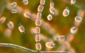 304_-Deadly-Fungus-Strikes-Washington-Are-You-at-Risk